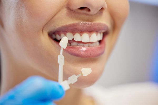 Enhance Smiles and Grow Your Practice with Teeth Whitening