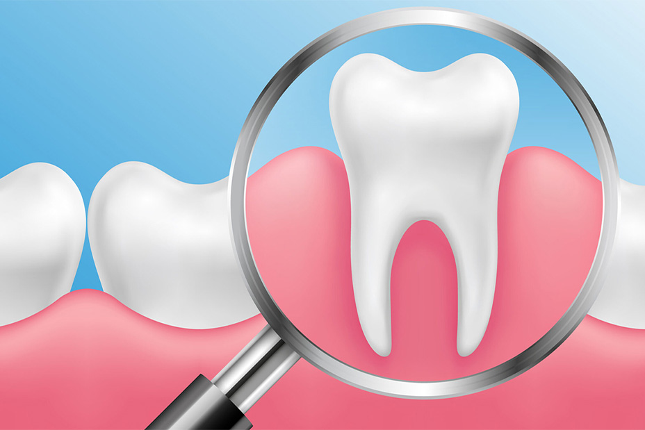 Teeth Whitening On-The-Go