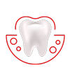 Gingivitis